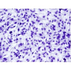 Mouse Preadipocytes - brown fat (MPAd-bf)